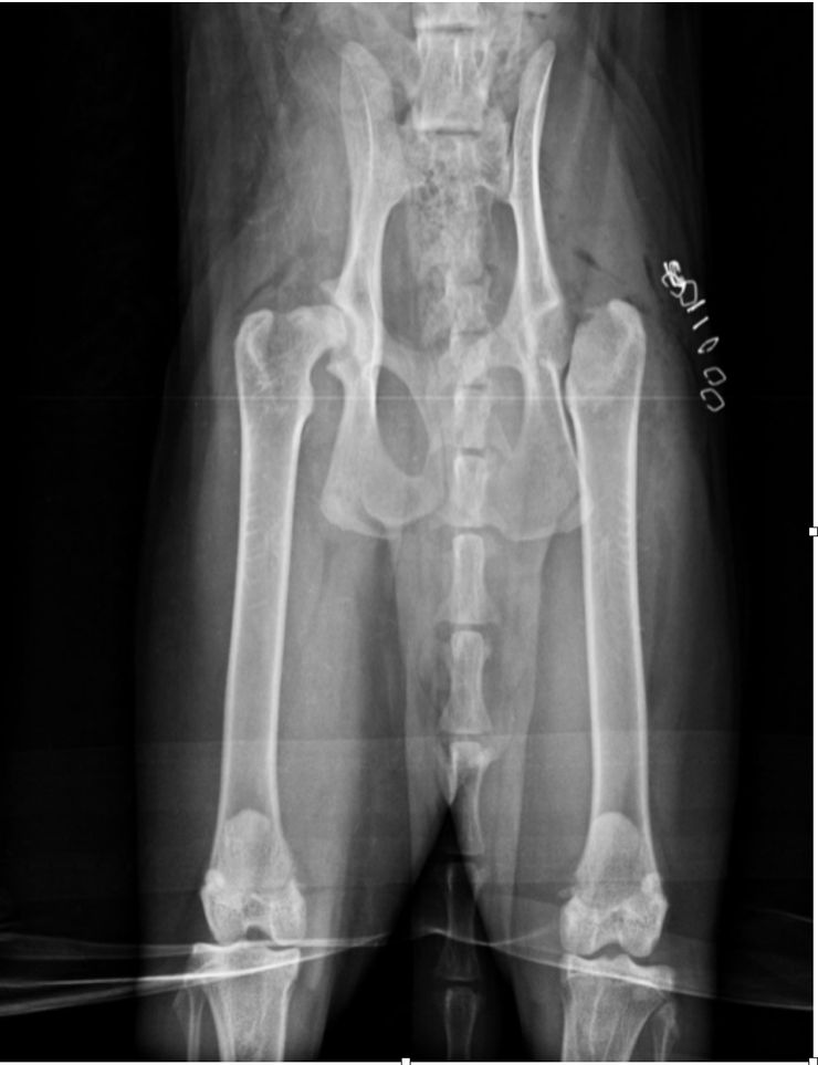 股骨頭切除術後x光