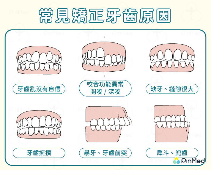 常見矯正牙齒原因