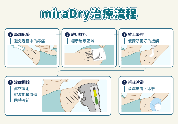 miraDry清新微波治療過程