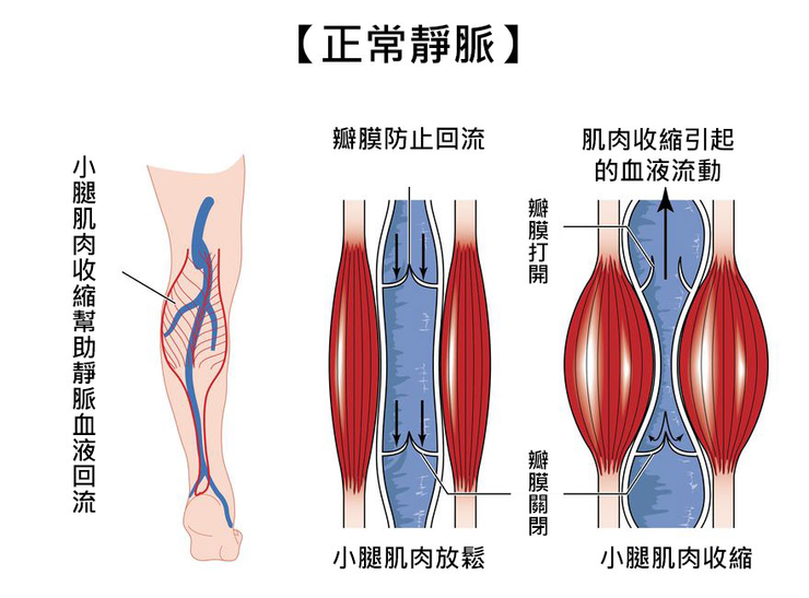 腿部肌肉收縮及瓣膜輔助促成血液正常回流