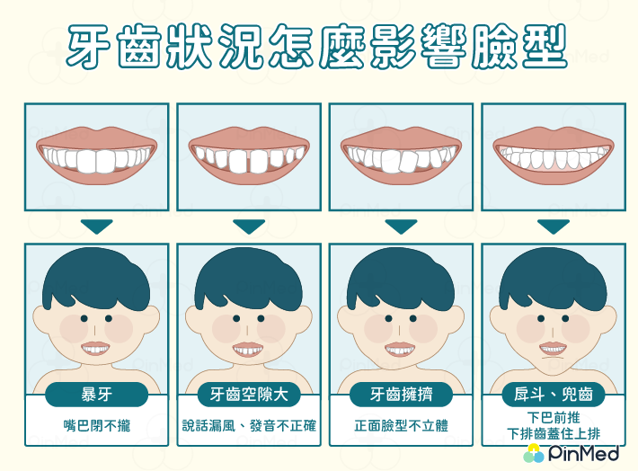 牙齒狀況怎麼影響臉型