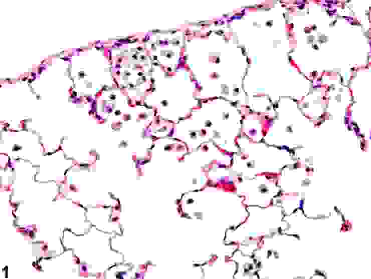 肺泡組織圖，圖片中的球形皆為肺泡巨噬細胞（感謝National Toxicology Program 提供）