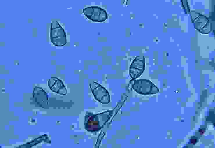 稻瘟病菌的分生孢子。圖片取自維基百科。