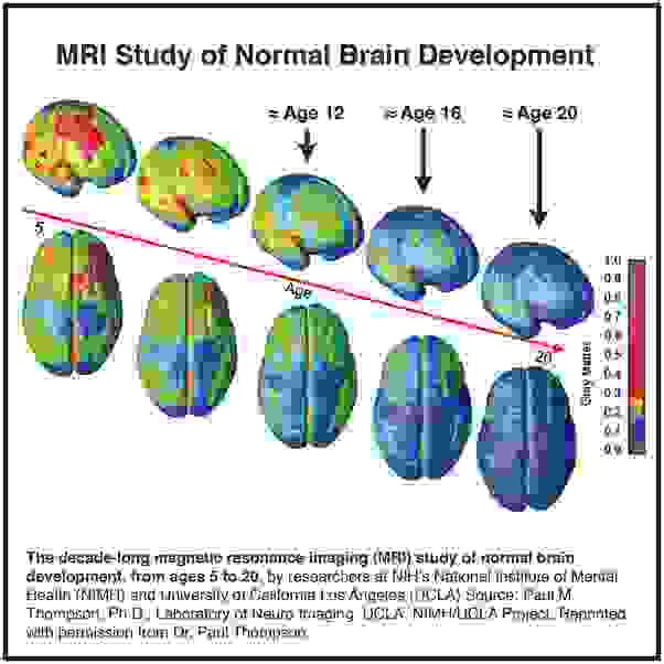 ▲大腦發展是由後往前。額葉的連結要到20歲之後