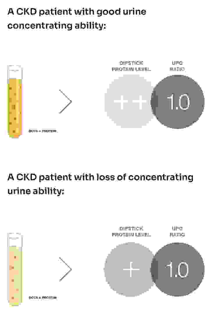 不同濃度的尿會影響尿液試紙的檢驗