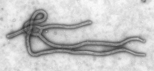 電子顯微鏡下的伊波拉病毒（感謝Cynthia Goldsmith提供）