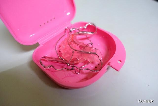 Hewley's retainer
哈雷維持器