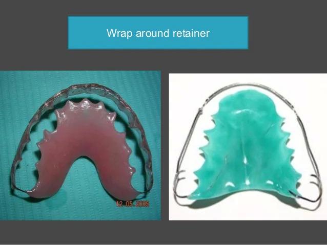 wrap around retainer