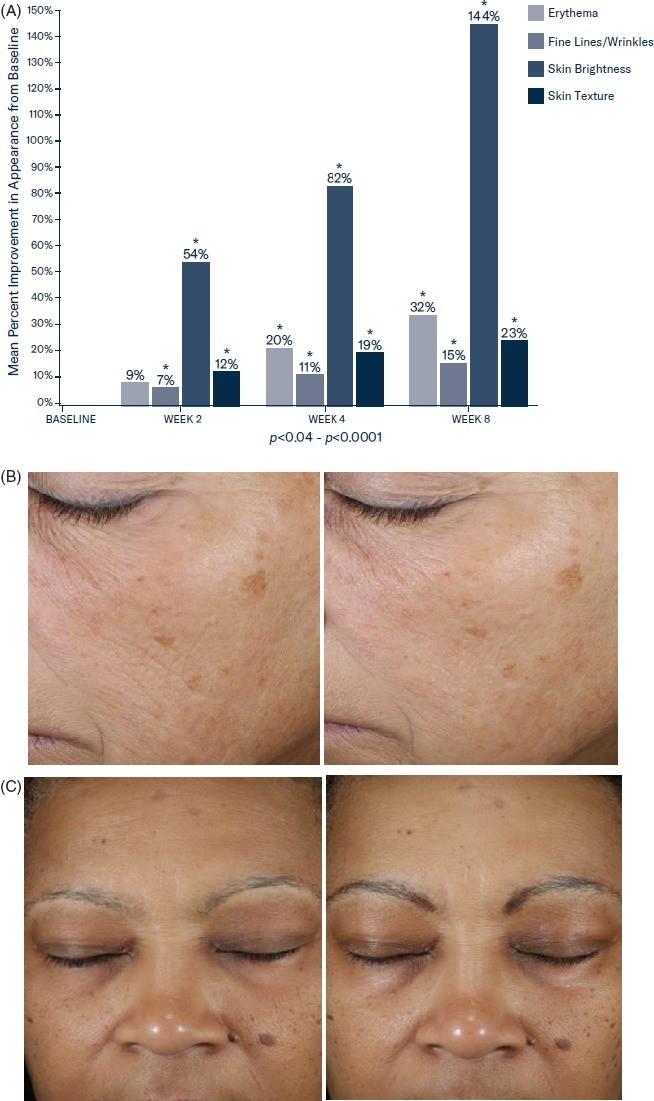 引用自David H. McDaniel等人研究《In vitro and in vivo evaluation of a moisture treatment cream containing three critical elements of natural skin moisturization》fig. 3